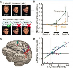 TMS Increased Memory