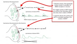 ketamine for depression - bdnf effects