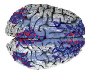 TMS Mechanism of Action - Default Mode Network