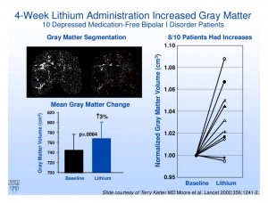 Lithium Increased Grey Matter