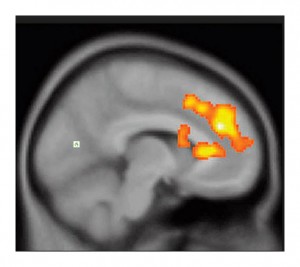 anhedonia and ketamine